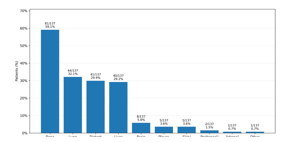 Grafico delle sedi di recidiva a distanza nel carcinoma mammario