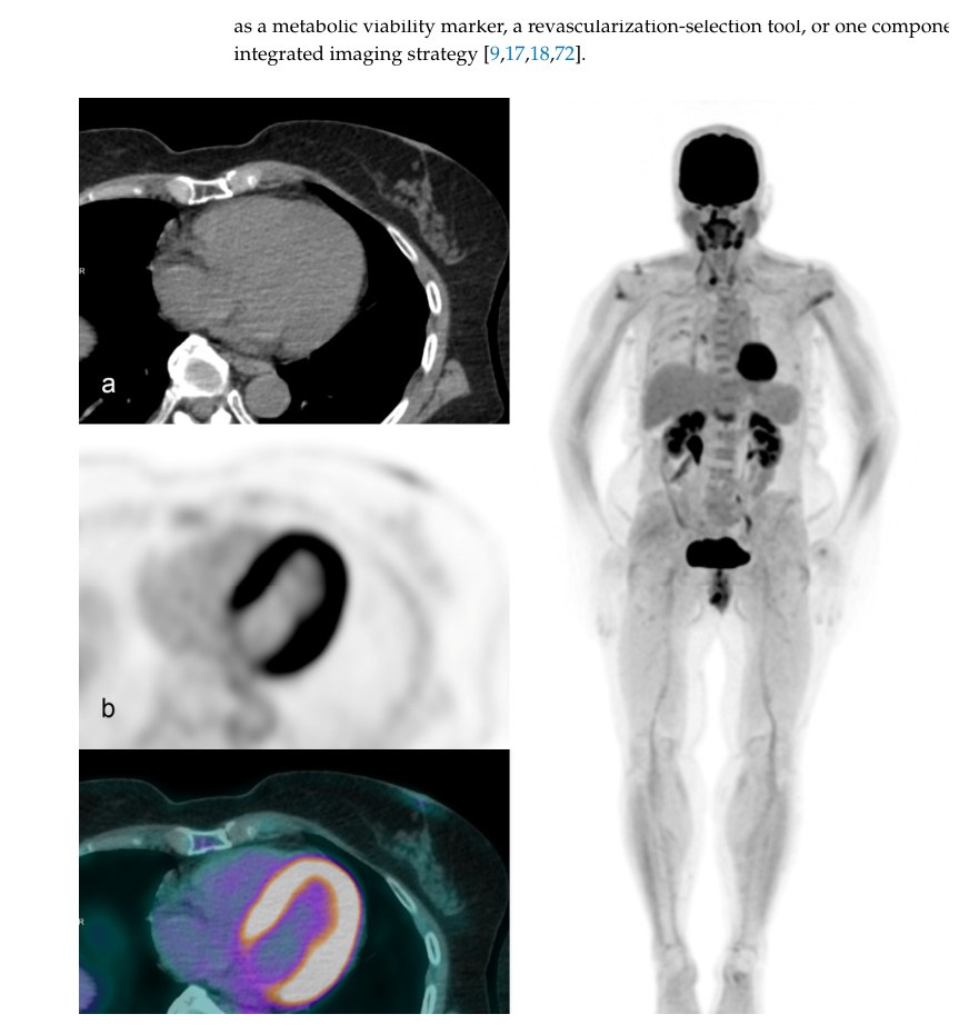 Immagini PET/CT cardiache con FDG